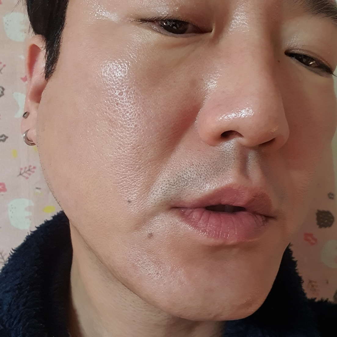 스킨1004 (SKIN1004) 마다가스카르 센텔라 프로바이오시카 인텐시브 앰플 review image