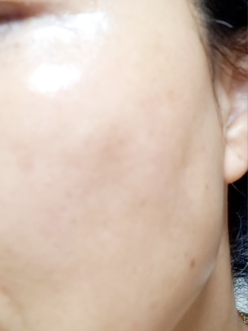 바노바기 (BANOBAGI) 비타 제닉 젤리 마스크 [하이드레이팅] review image