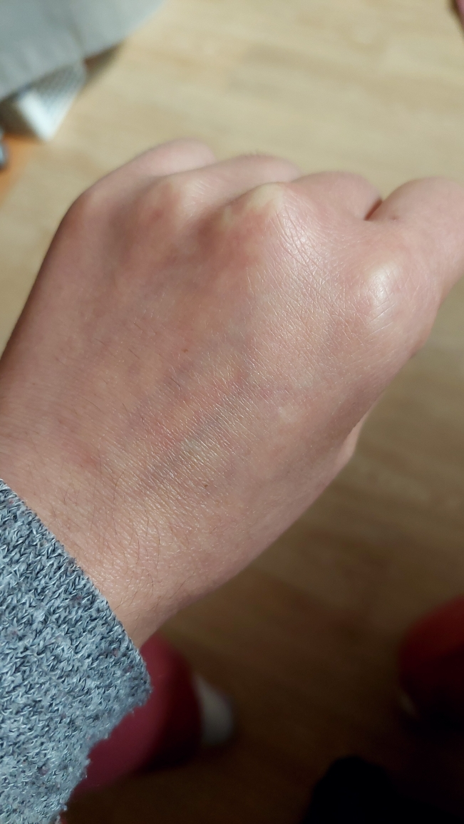 KISSMUSES 抗皱眼部提升面膜 review image