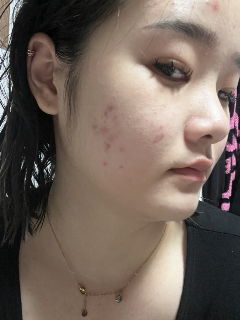 바이오더마 (BIODERMA) 세비엄 세럼 review image