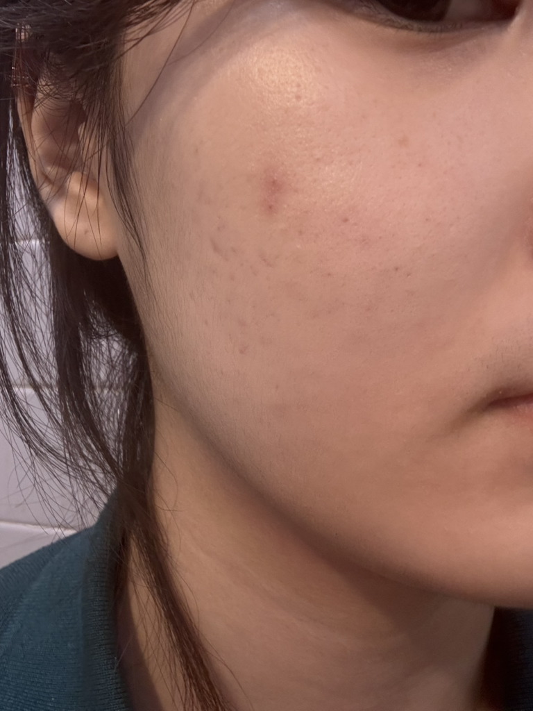 바이오더마 (BIODERMA) 세비엄 세럼 review image