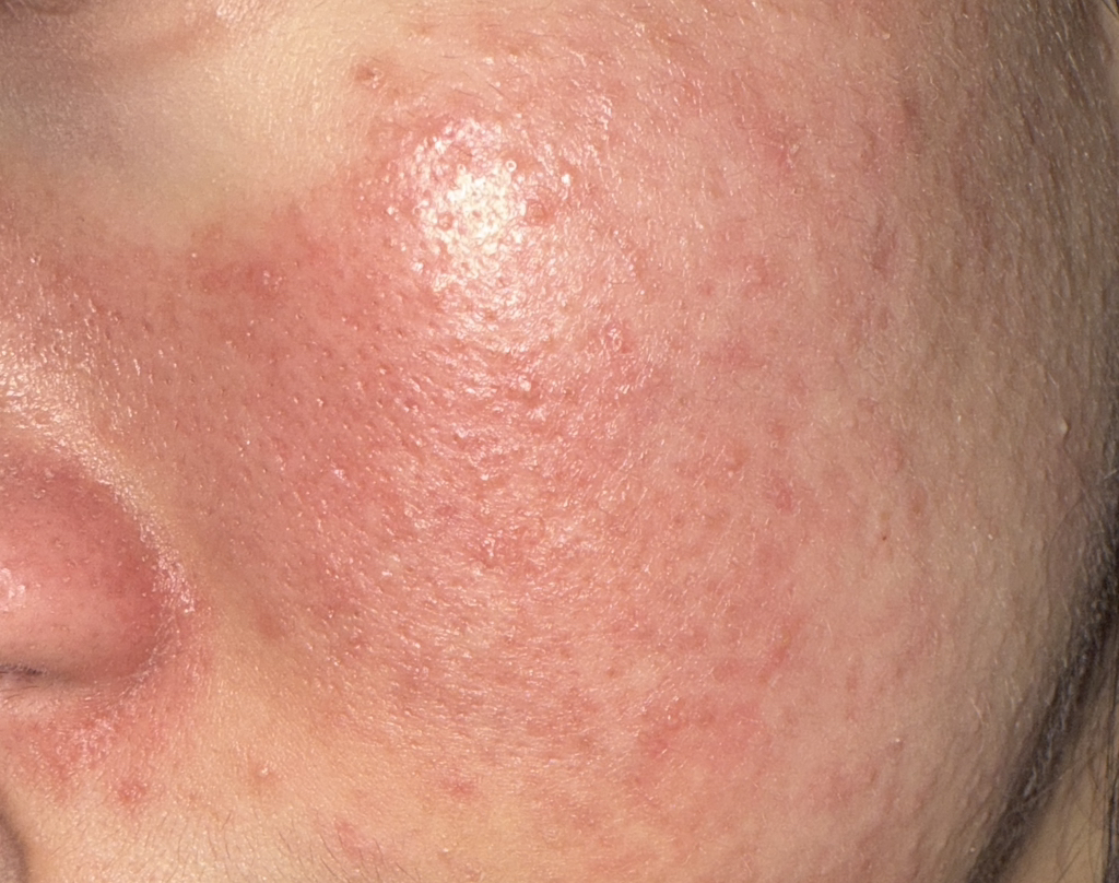 미샤 (MISSHA) 25주년 에디션 M퍼펙트 커버 비비크림 EX [SPF42/PA+++] [21호] review image