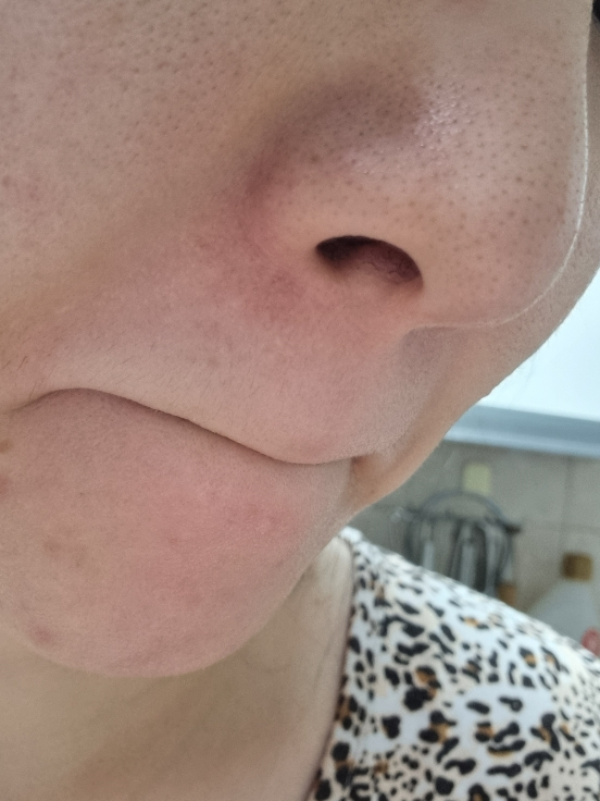 비플레인 (beplain) 시카 PDRN 스킨 부스터 세럼 review image