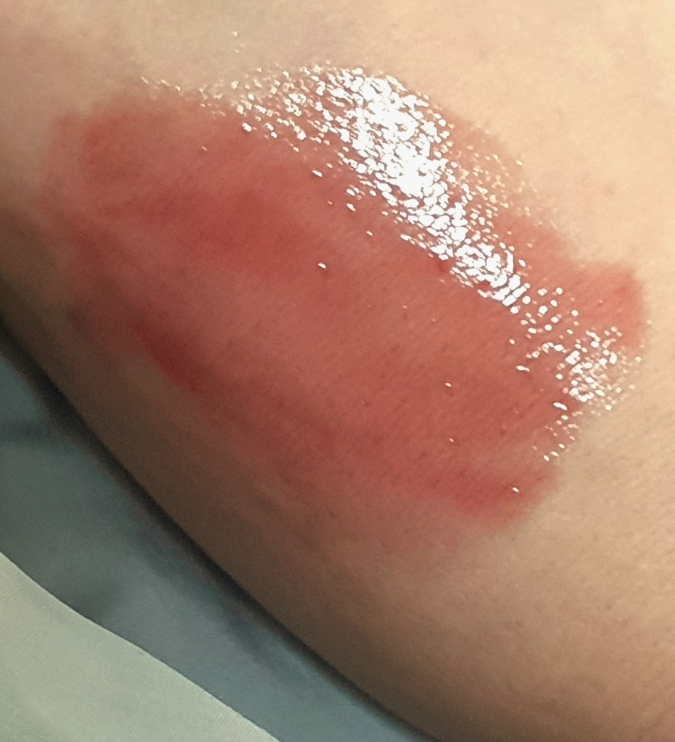 태그 (TAG) 듀이멜팅밤 [2호 로즈티] review image