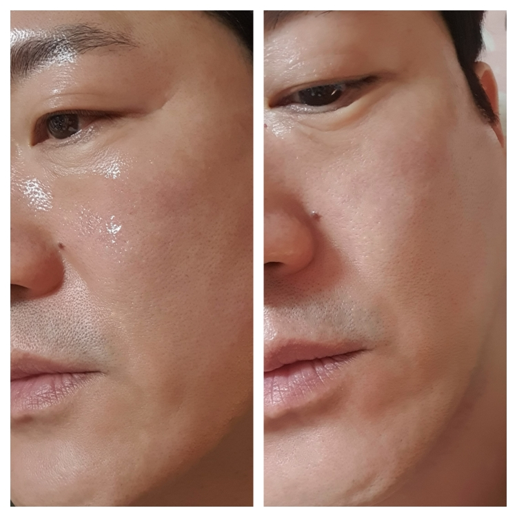 엠디스픽 (MD'SPICK) 테카테카 카밍 딥 앰플 review image