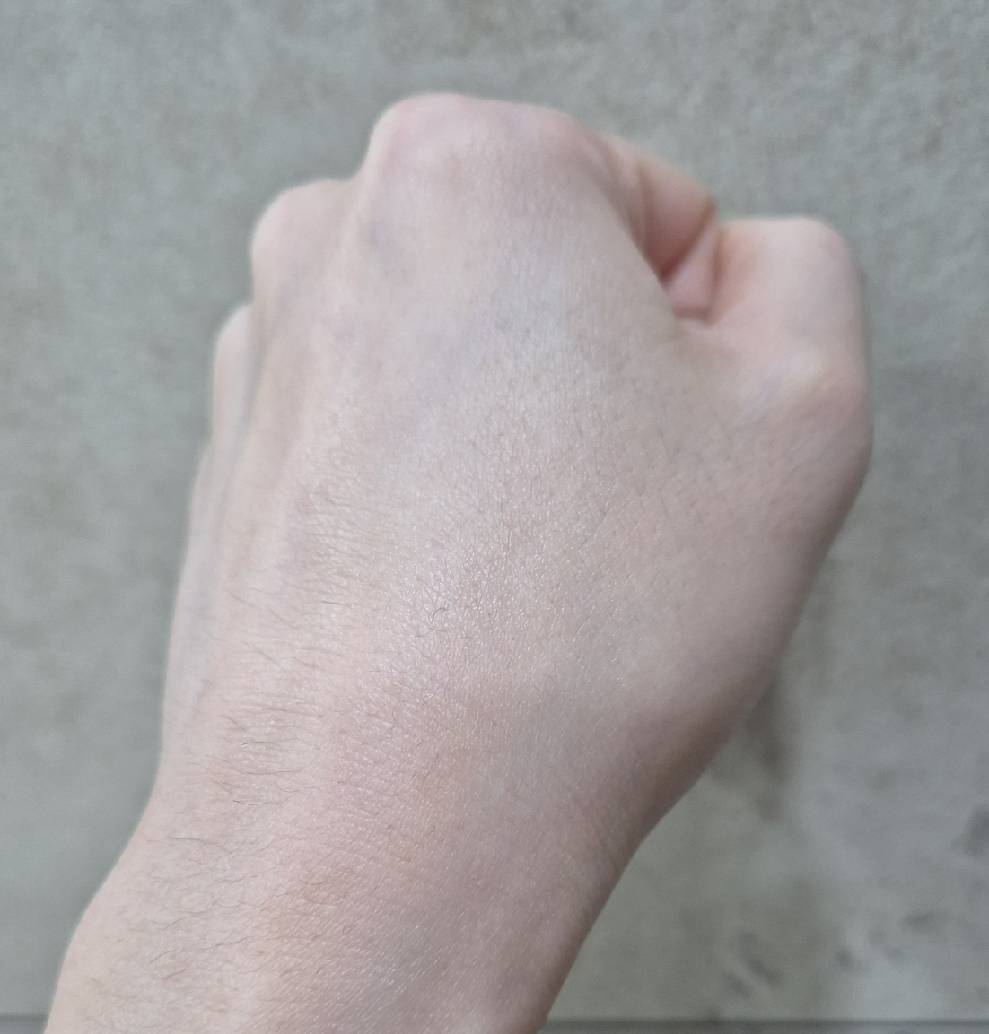 丽欧蓓莉 CicarilifRx 镇静霜 review image