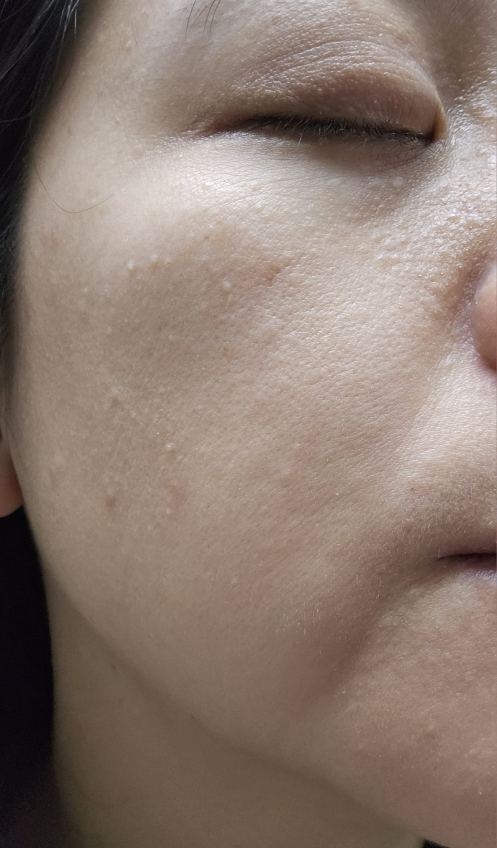 바노바기 (BANOBAGI) 비타 제닉 젤리 마스크 [리프팅] review image