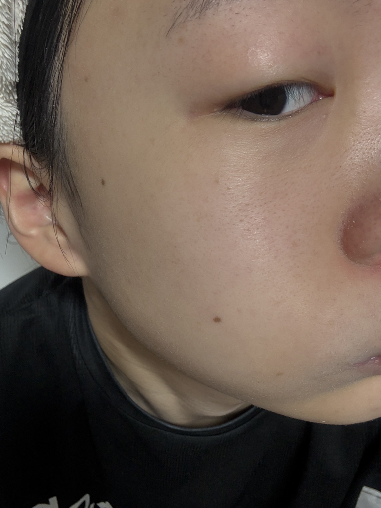 탈리다쿰 (TalithaKoum) HM+Barrier™ 화이트 단델리온 에센스 수 review image