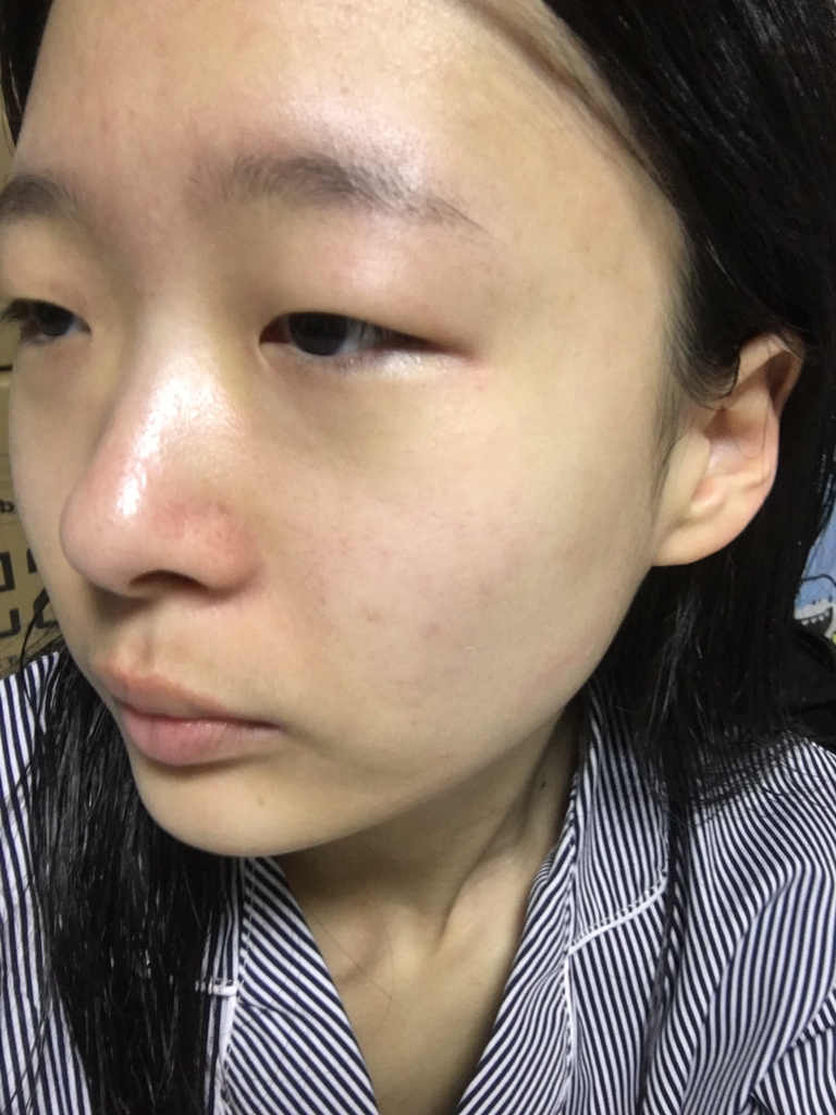 탈리다쿰 (TalithaKoum) HM+Barrier™ 화이트 단델리온 에센스 수 review image