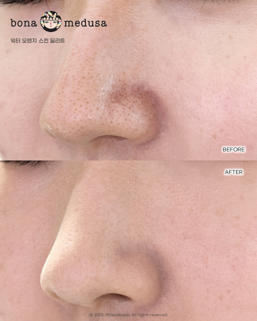 보나메두사 (bonamedusa) 워터 오렌지 스킨 딜리트 review image