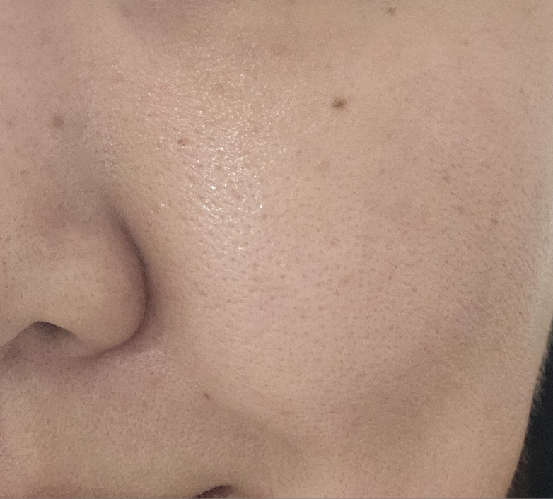 보나메두사 (bonamedusa) 워터 오렌지 스킨 딜리트 review image