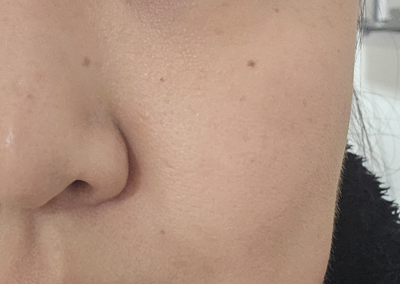 보나메두사 (bonamedusa) 워터 오렌지 스킨 딜리트 review image