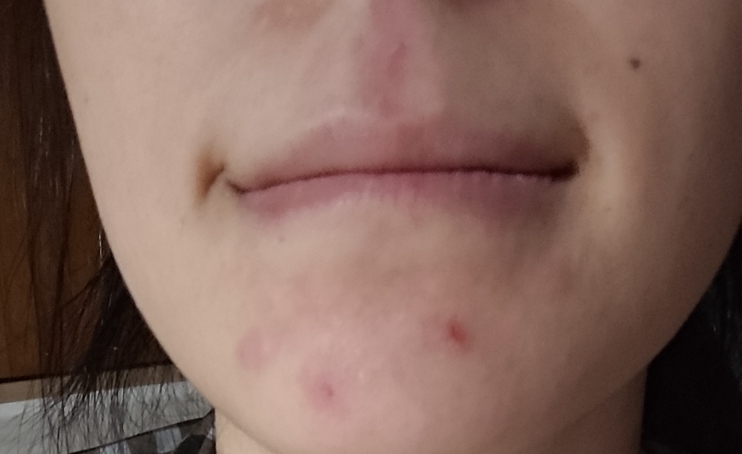 셀라딕스 (Celladix) 트러블 클리어 약산성 젤클렌저 review image