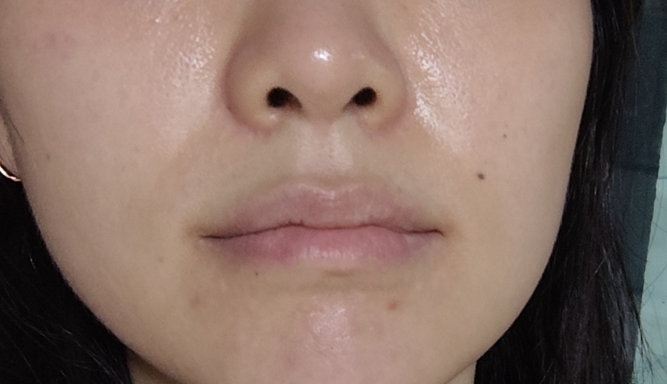 셀라딕스 (Celladix) 트러블 클리어 약산성 젤클렌저 review image