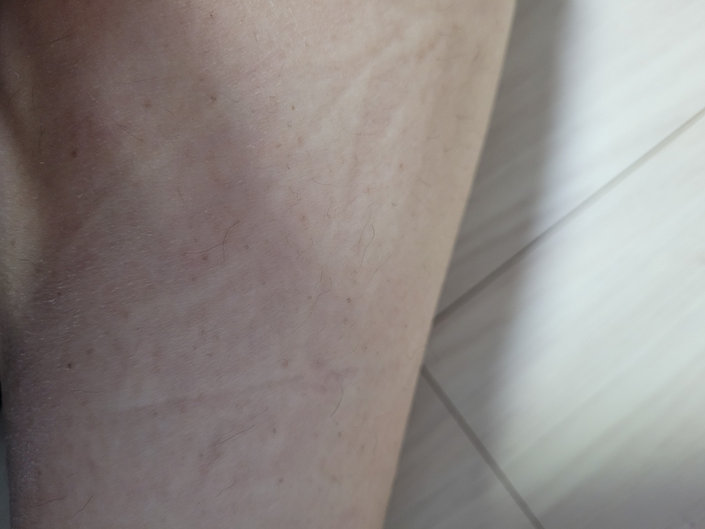 아렌시아 (ARENCIA) 레드 스무디 로션 5 review image