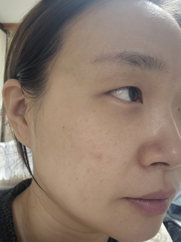 이지듀 (Easydew) DW-EGF 멜라토닝 원데이 앰플 review image