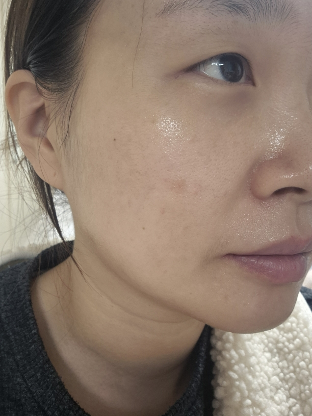 이지듀 (Easydew) DW-EGF 멜라토닝 원데이 앰플 review image