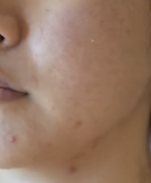 바이오던스 (Biodance) 래디언트 비타 나이아신아마이드 리얼 딥 마스크 review image