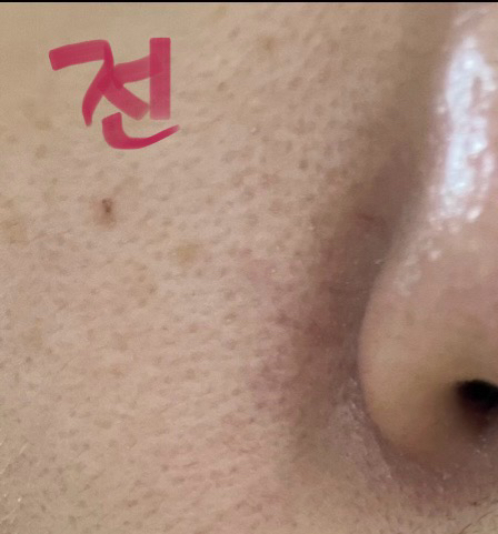 오드로이 (ODELOI) 모공수축 시카 83.7 콜라겐 미스트 앰플 로프디 review image