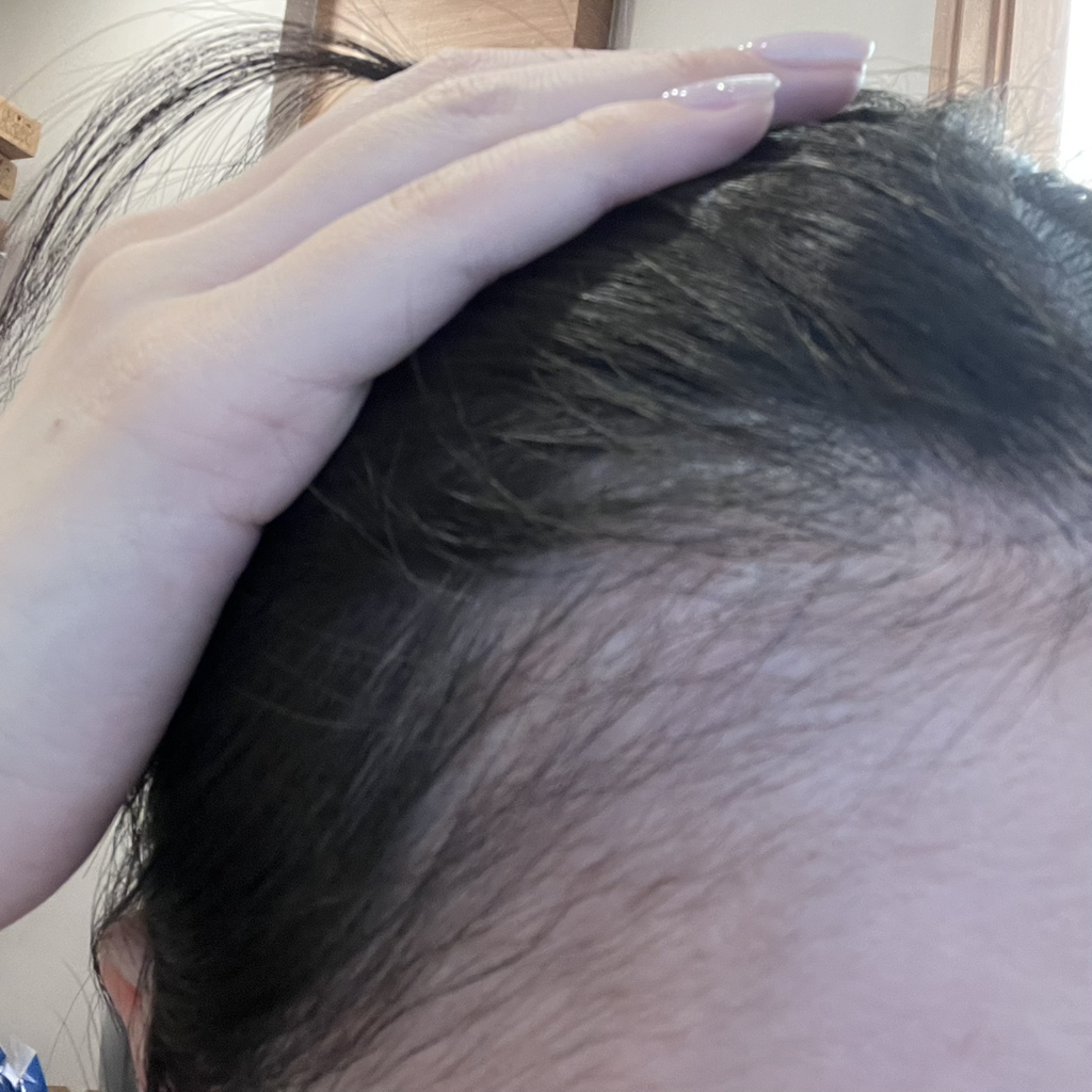 바이브랩 (ViveLab) 스피옥실 리액트샷 400 탈모앰플 review image