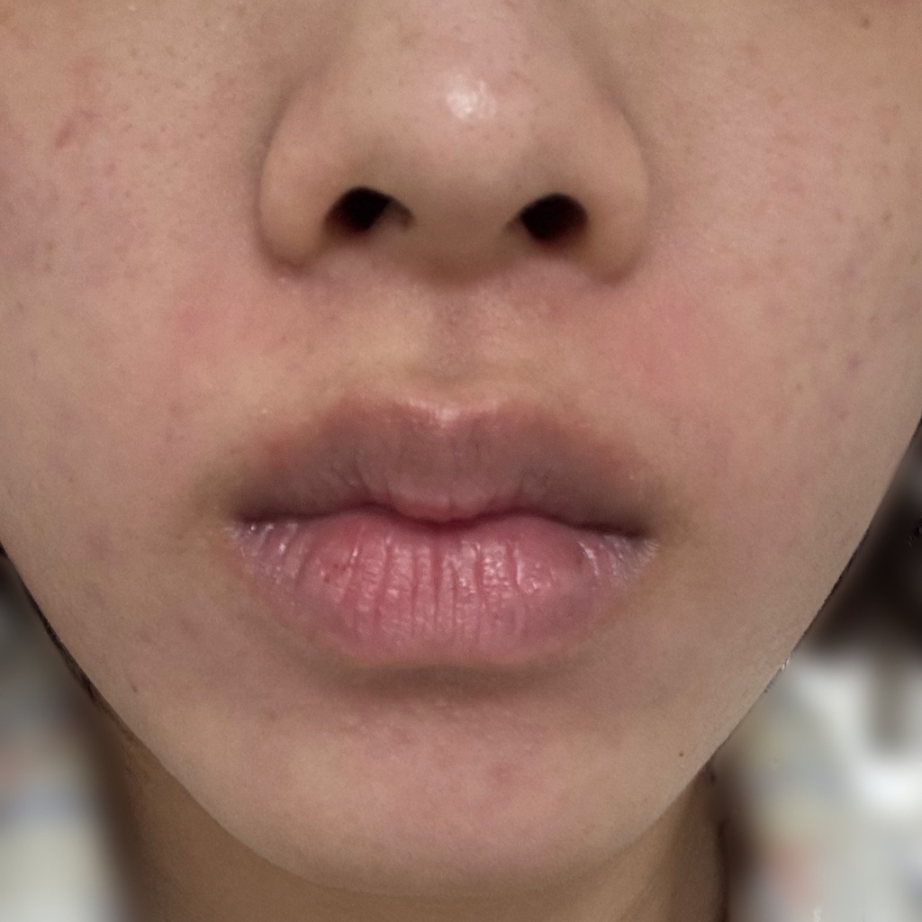 넘버즈인 (numbuzin) 4번 SOS 응급진정 얼음장팩 review image