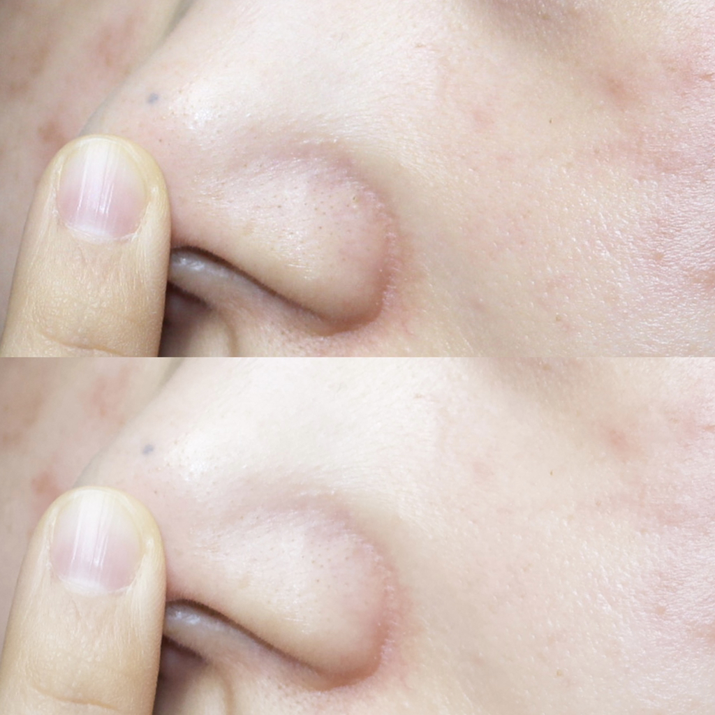 듀댑 (dewdap) 시카티 모공피지 팩 클렌저 review image