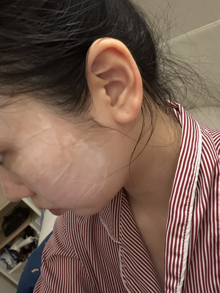 벨프리모 (BELPRIMO) 히알글로우 필오프팩 review image