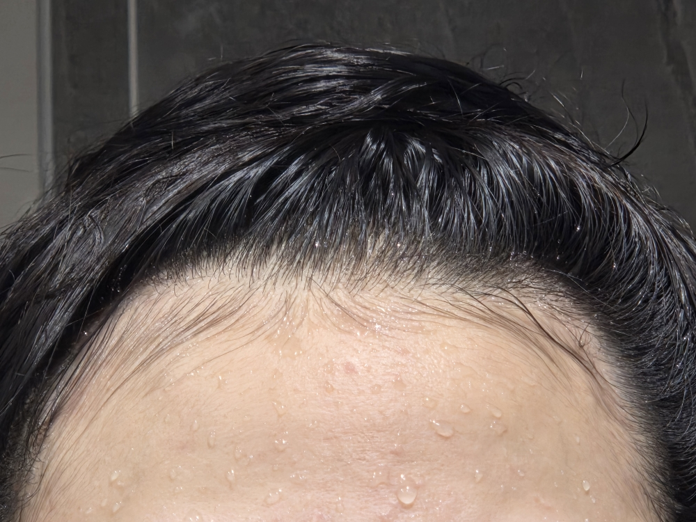 리필드 (Refilled) 사이토카인 부스터 [프로] review image