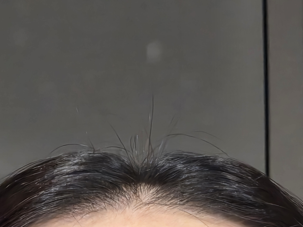 리필드 (Refilled) 사이토카인 부스터 [프로] review image