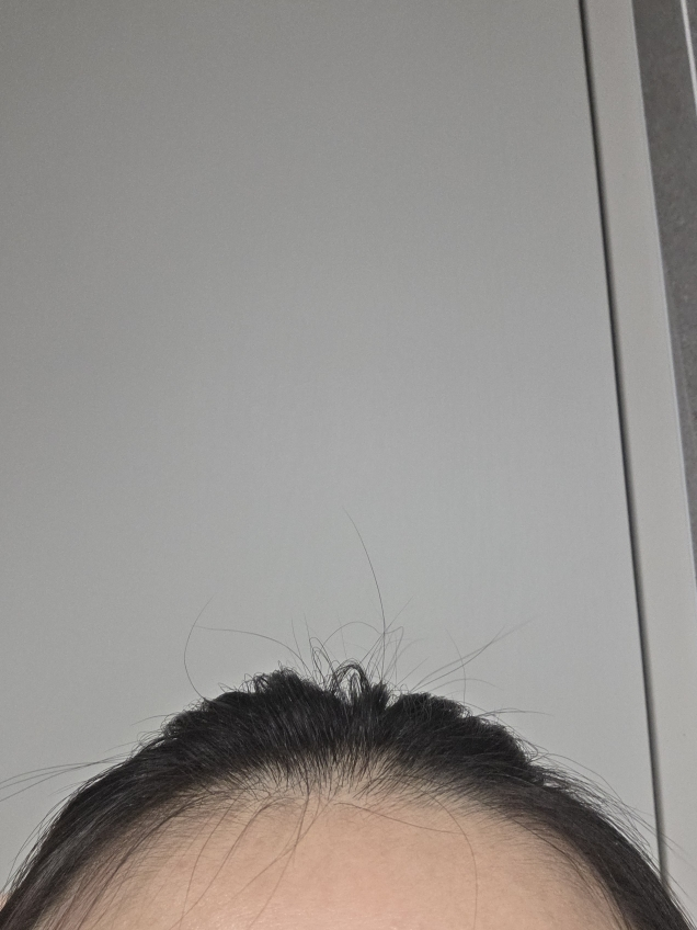 리필드 (Refilled) 사이토카인 부스터 [프로] review image