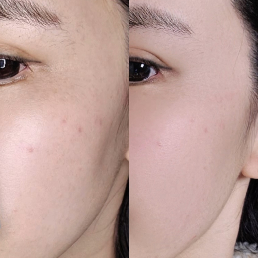 ALIVELAB Centella en polvo review image