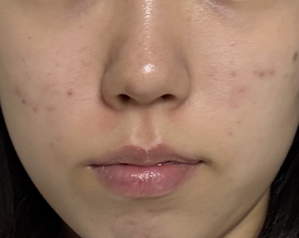 차앤박화장품 (CNPLaboratory) 프로폴리스 에너지 앰플 미스트 review image