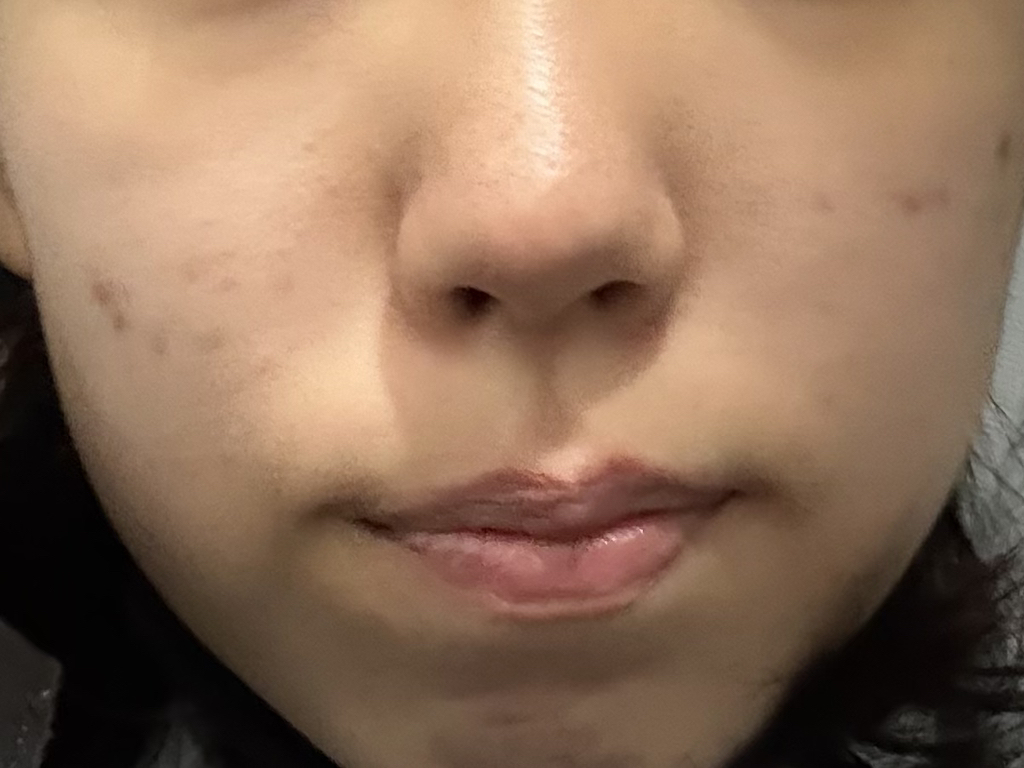 차앤박화장품 (CNPLaboratory) 프로폴리스 에너지 앰플 미스트 review image