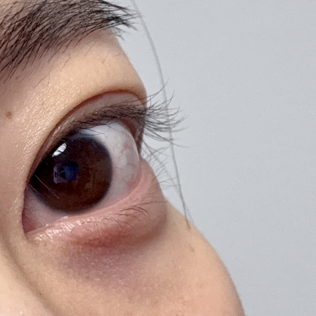 리필드 (Refilled) 사이토카인 아이래쉬 듀얼 앰플 review image