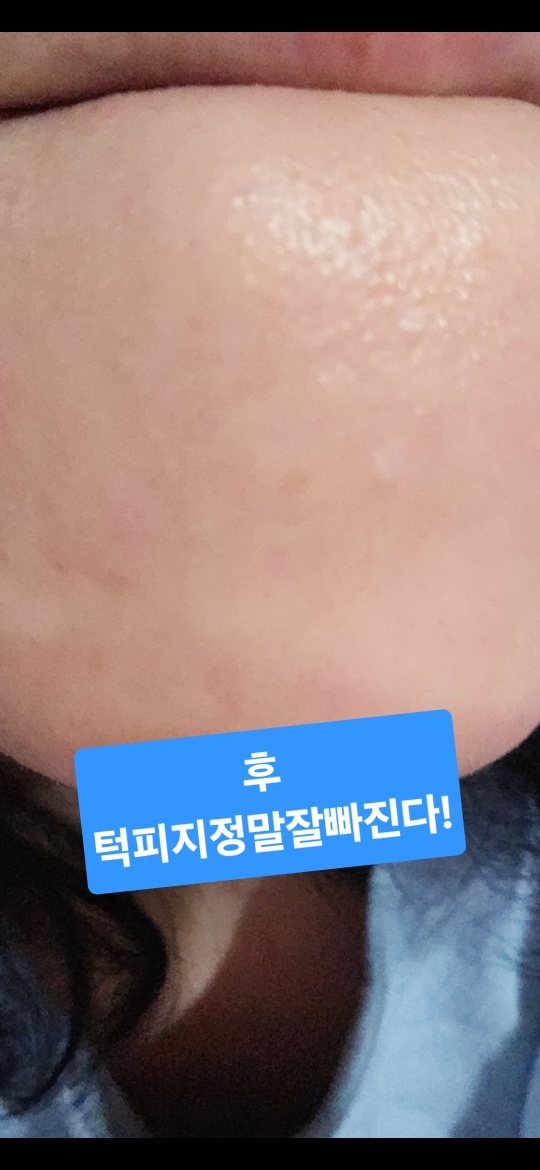 MEDIPEEL Green Sika Colágeno Gel Limpiador Transparente 2.0 review image