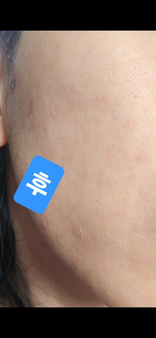 COSRX The Niacinamide 15 Serum review image