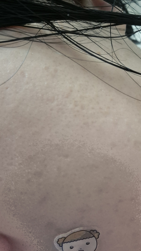 코스알엑스 (COSRX) 더 알파-알부틴 2 디스컬러레이션 케어 세럼 review image