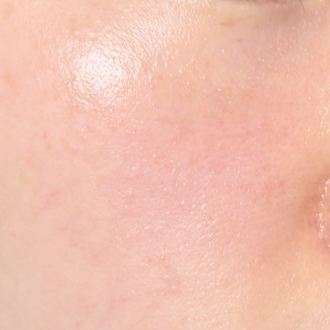 제나벨 (Genabelle) PDRN 인리치드 리커버리 밤 review image