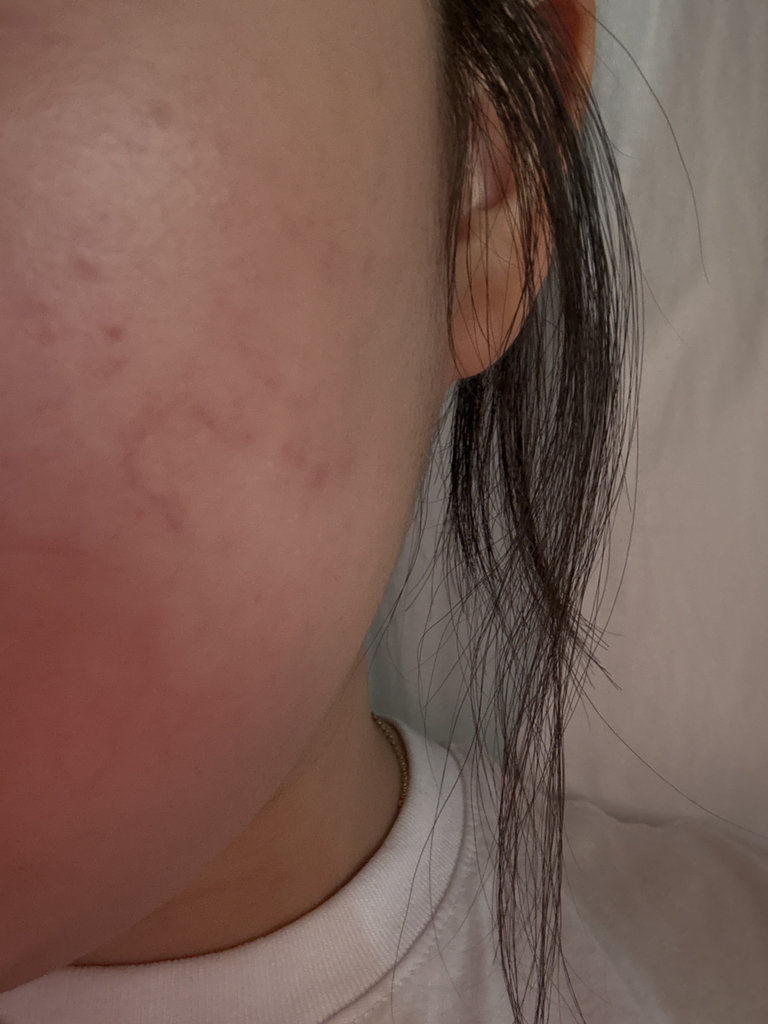 ISOI Arkney Doctor 1er Control Serum review image