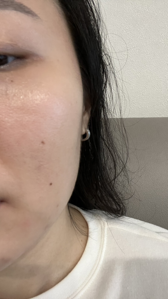 아누아 (Anua) PDRN 히알루론산 캡슐 100 세럼 review image