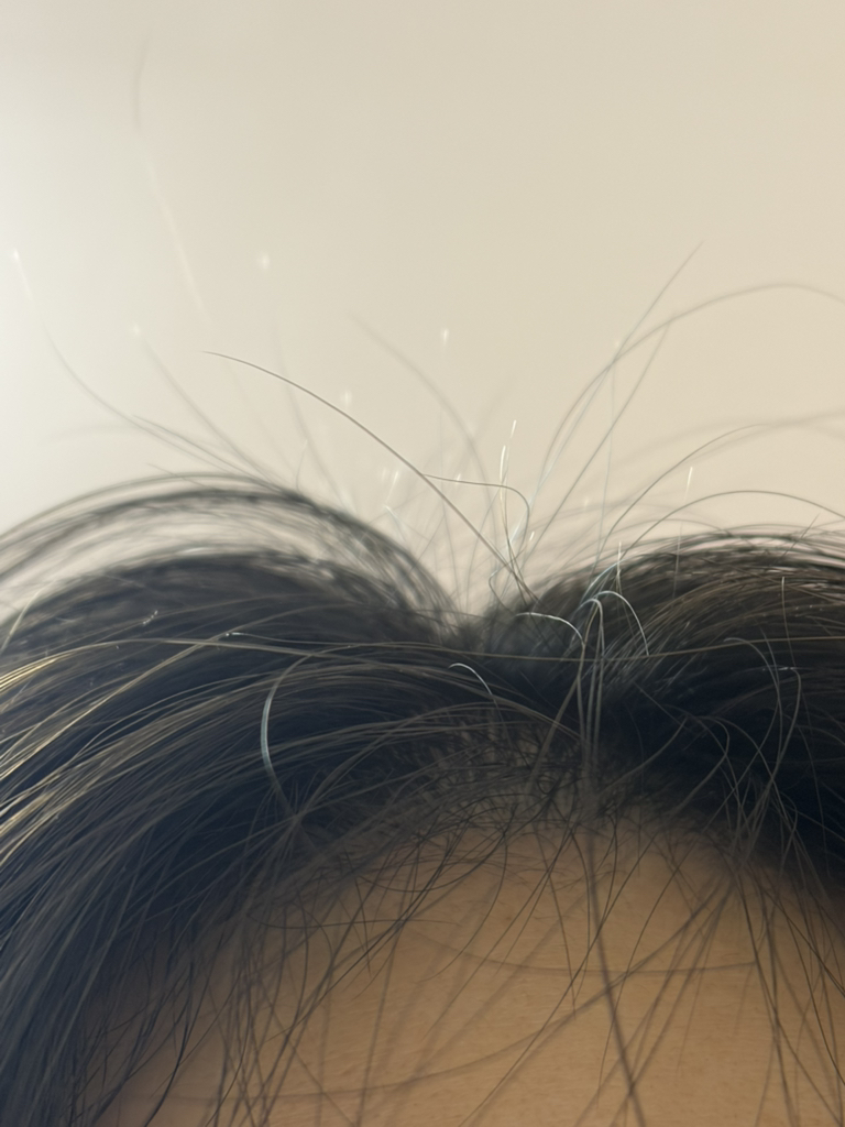 리필드 (Refilled) 사이토카인 부스터 [프로] review image