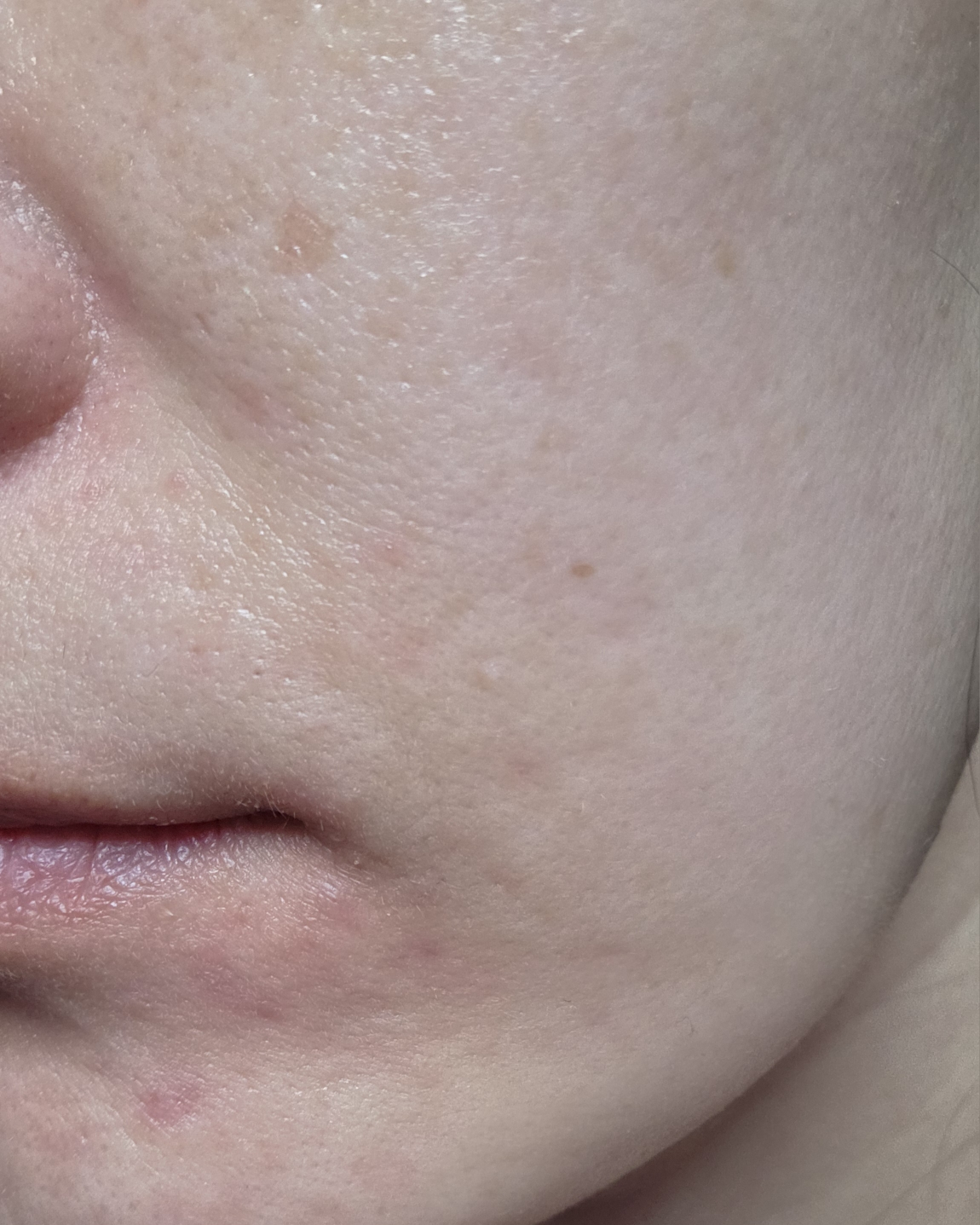 이니스프리 (INNISFREE) 레티놀 그린티 PDRN 스킨부스터 앰플 review image