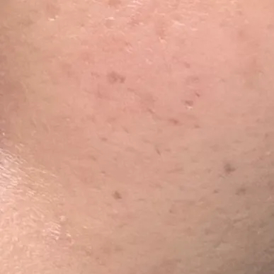 보나메두사 (bonamedusa) 오렌지 스킨 딜리트 [오리지널] review image