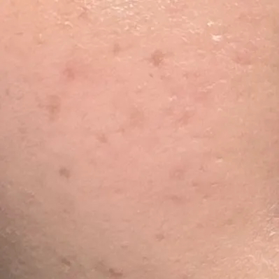 보나메두사 (bonamedusa) 오렌지 스킨 딜리트 [오리지널] review image