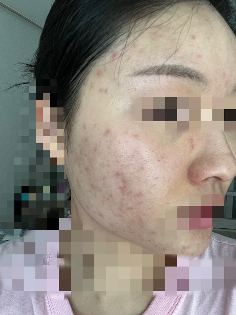 이즈앤트리 (IsNtree) 어니언 뉴페어 겔 크림 review image