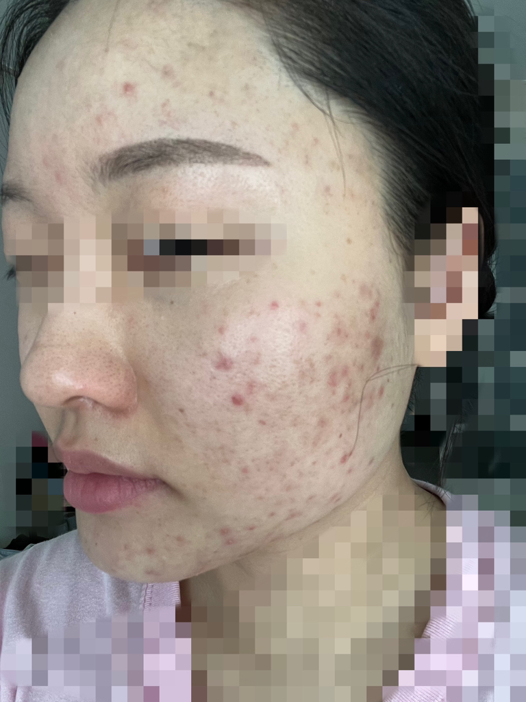 이즈앤트리 (IsNtree) 어니언 뉴페어 겔 크림 review image