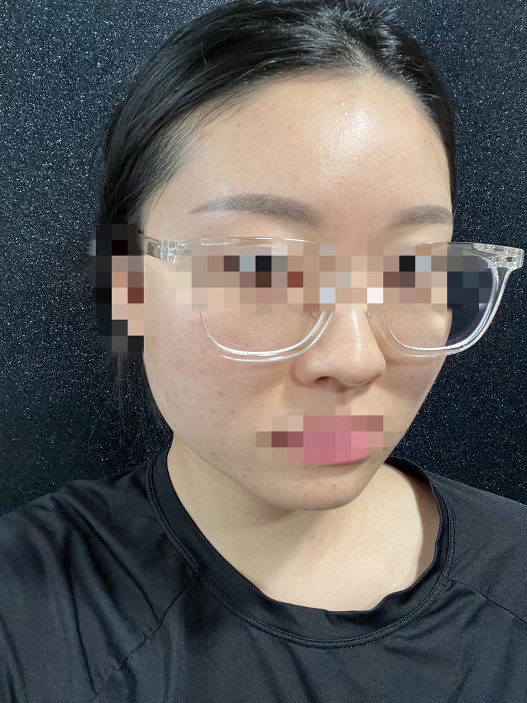 이즈앤트리 (IsNtree) 어니언 뉴페어 겔 크림 review image