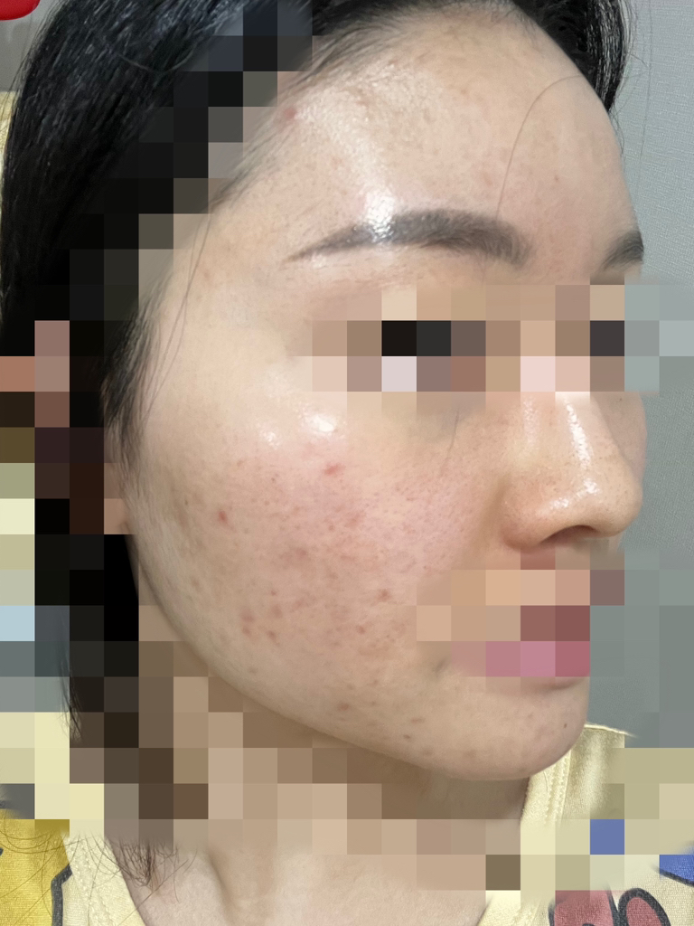 이즈앤트리 (IsNtree) 어니언 뉴페어 겔 크림 review image