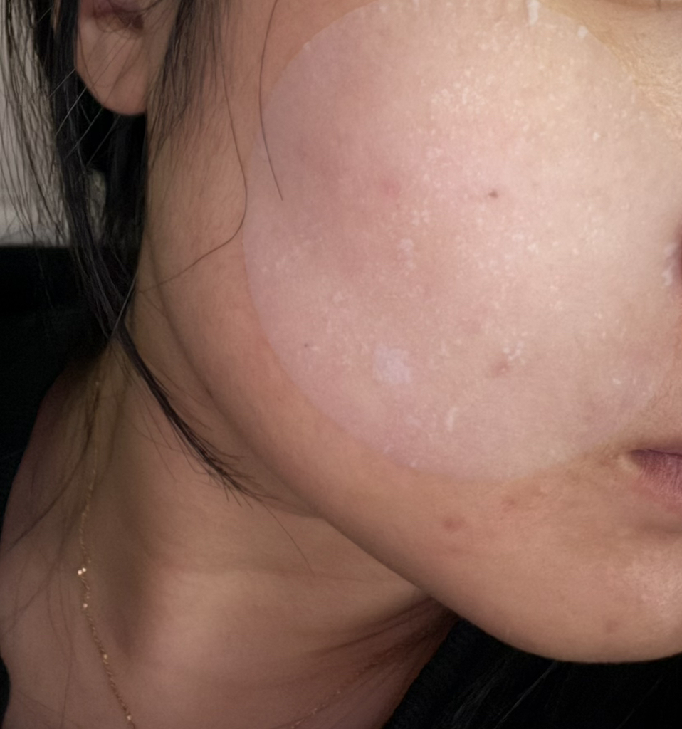 키노닉스 (keenoniks) 아줄렌 수분 밀착 패드 review image