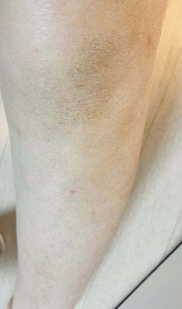 몽디에스 (mongdies) 아토 크림 review image